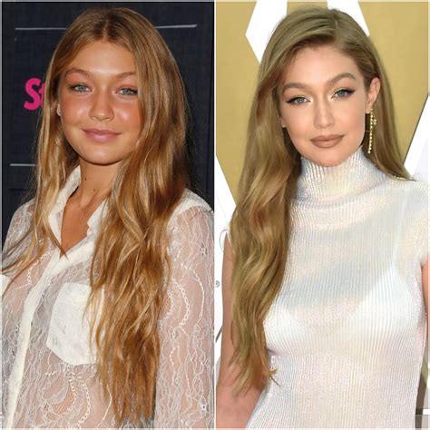 gigi hadid plastic surgery|21 Celebs Who Addressed Plastic Surgery。